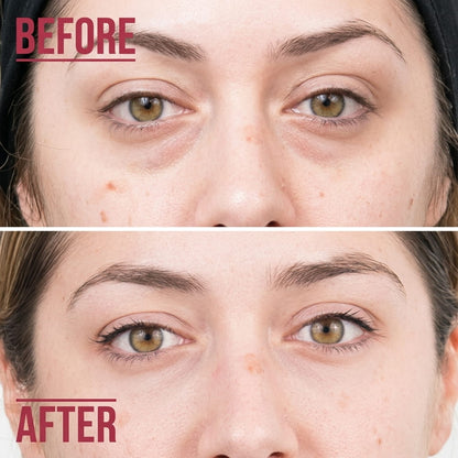 DermaEyeFX Device